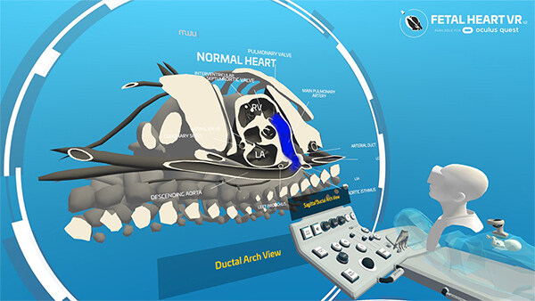 心脏病医学VR Fetal Heart VR