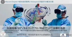 Wacom 收购医学影像公司 Holoeyes，发力 VR+医疗新场景